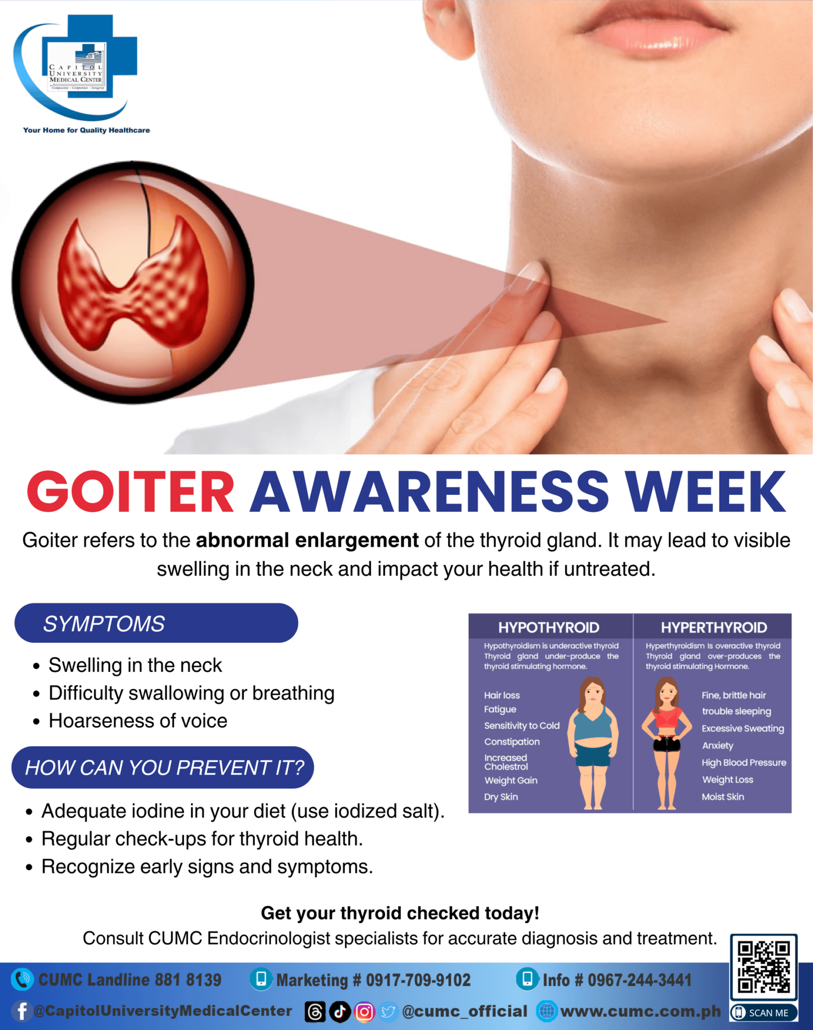 Goiter Approach Goiter Awareness Week - CUMC